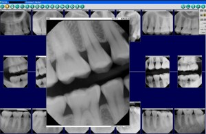 Austin Westlake Dentist that uses digital x-rays